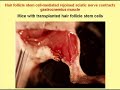 Stem cells in hair follicle that repair nerves - Part 2