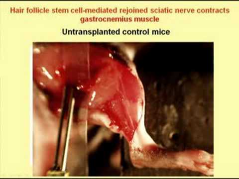 how to repair hair follicles