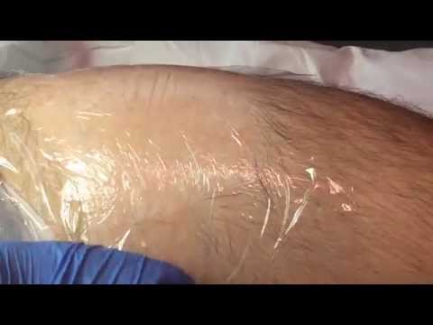 how to avoid itching