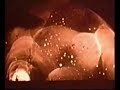 Explosiones nucleares Explosiones nucleares