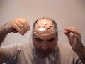 making a tape mold template for hairpieces by michigan baldy
