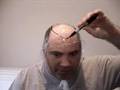Making a Tape Mold Template for Hairpieces by Michigan Baldy