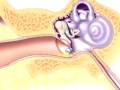 Malpractice Medical Myringotomy Insertion of Tube 2