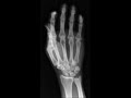 Hoyt Axton - Boney Fingers Hoyt Axton - Boney Fingers