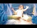 World's Youngest Person Born