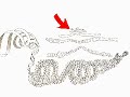 Chromosomes