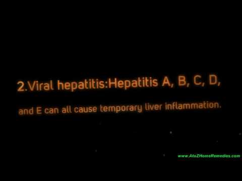 how to cure jaundice naturally