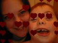 Down syndrome:&nbsp;Down Syndrome Awareness