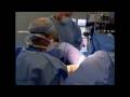 Labia & Clitoropexy in Beverly Hills