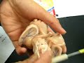 BRAIN STEM BRAIN STEM