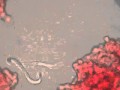 title="Microfilaria"