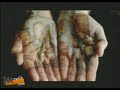 YPF - hicimos