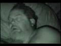 Sleep Apnea