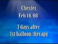 2-14-08-3-days-after