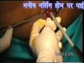 PILES in Hindi