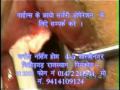 PILES in Hindi