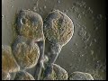 EPISTYLIS II. CILIATE