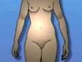 Malpractice Medical Laparoscopy Diagnostic 1