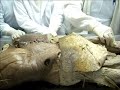 anatomia   miembros inferiores basico