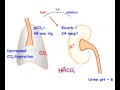 Respiratory acidosis