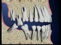 bangkok smile dental clinic, your beautiful smile begins with a thorough examination. because your dental health is important, we thus put our effort to ensure that you have a healthy smile that lasts for a lifetime. your new dental implant in thailand experience begins here at bangkok smile dental clinic. implants bangkok