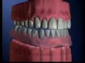 Dental Implants Bangkok, Thailand/www.thaiimplantcenter.com Dental Implants Bangkok, Thailand/www.thaiimplantcenter.com