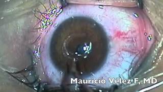 Mauricio Velez Fernandez-26