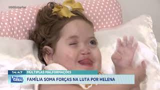 Múltiplas malformações: família soma forças na luta por Helena