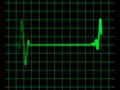 Animated heart rate monitor - electrocardiogram Animated heart rate monitor - electrocardiogram