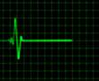 Animated heart rate monitor - electrocardiogram