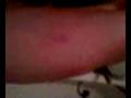 videos de paintball blessure