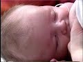 Breastfeeding using a Lactation Aid with Dr. Jack Newman