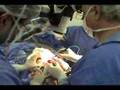 neurosurgery