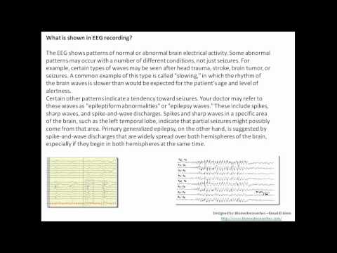 Understanding EEG- Part 6: More details, What is electroencephalography (EEG)?