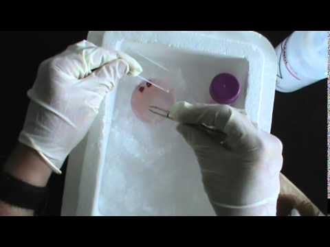 how to isolate splenocytes