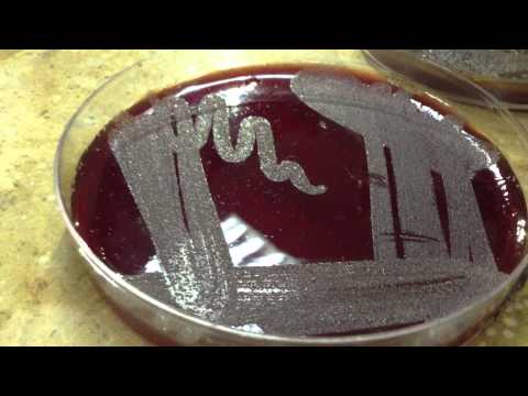how to isolate neisseria gonorrhoeae
