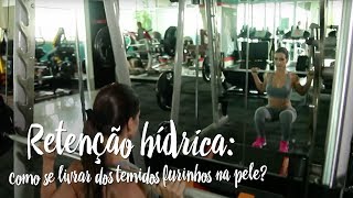 Celulite x Retenção hídrica: como se livrar dos temidos furinhos na pele?
