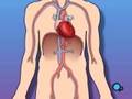 PreOp® Patient Education Cardiac Catheterization Angiograph