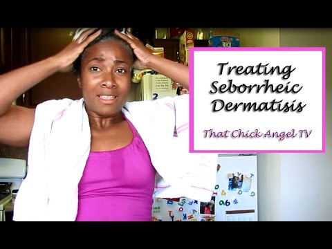 how to get rid of eczema in the scalp