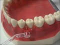 Studio Dentistico Dr Caruso - Treviso: Istruzioni igiene dentale e orale