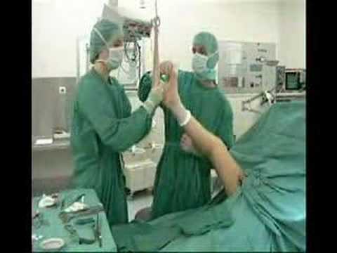 safenectomia - safenectomia.