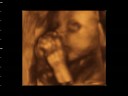 BIANCA VALERIA BENGOA RIOS - 25 SEMANAS II