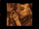 BIANCA VALERIA BENGOA RIOS - 25 SEMANAS II