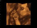 BIANCA VALERIA BENGOA RIOS - 25 SEMANAS II