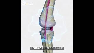 닥터프로칸 (관절약)