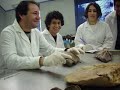 sistema Digestivo: Higado I