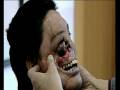 My Shocking Story - Human face transplant