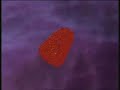 HIV infection
