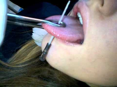 pierced - My girlfriend finally gets her tongue pierced WARNING not for people who are squeamish.