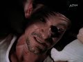 X-Factor (Staffel 3, Episode 5) - Anatol